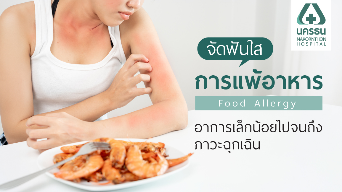 อาการแพ้อาหาร
